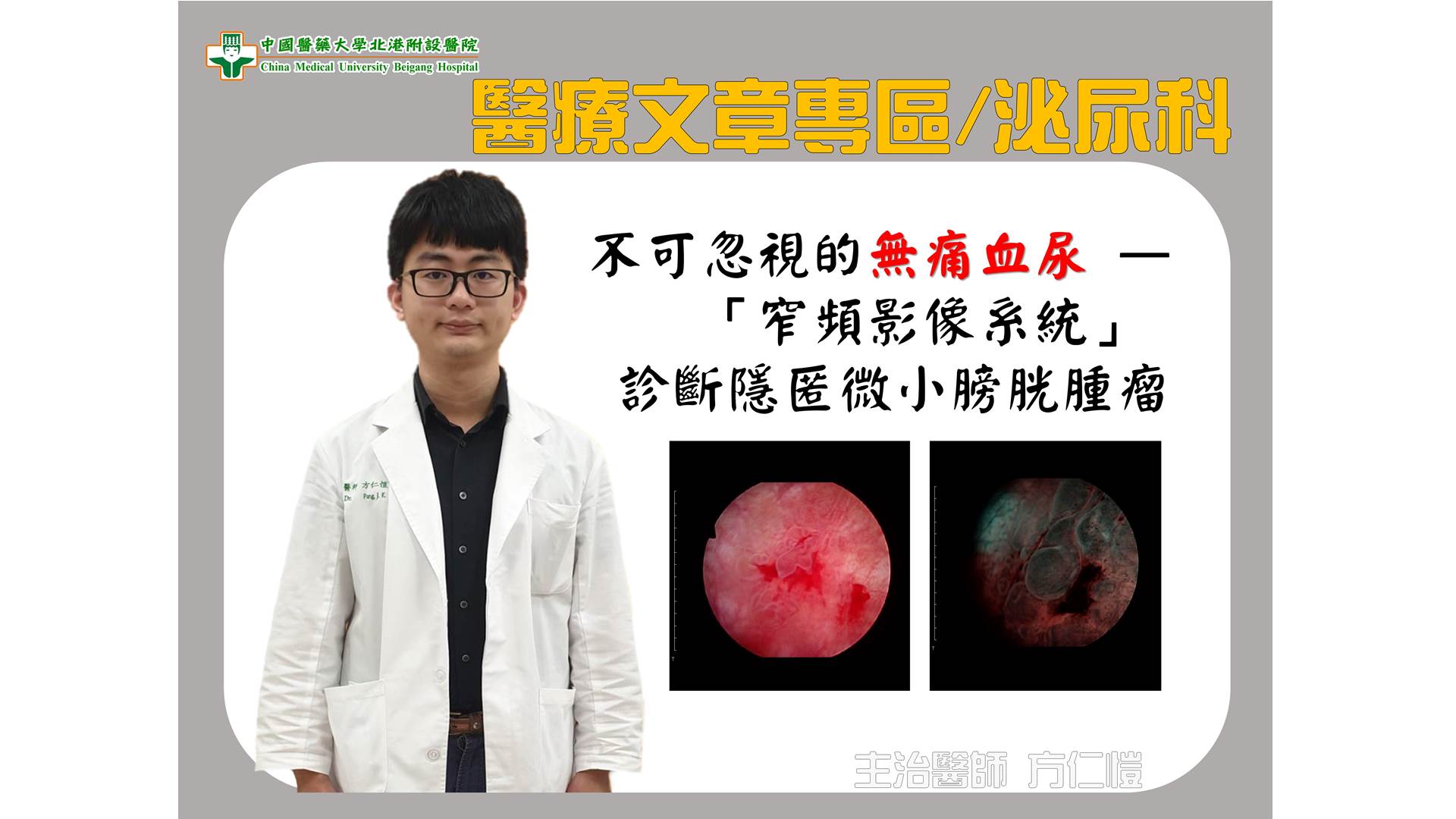 「窄頻影像系統」 診斷隱匿微小膀胱腫瘤